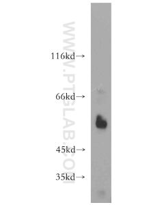 WT1 Polyclonal antibody proteintech 12609-1-AP