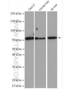 ABCG5 Polyclonal antibody proteintech 27722-1-AP