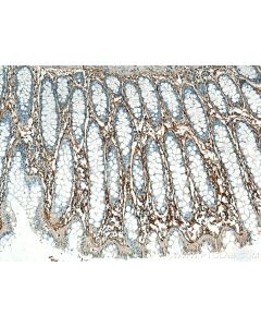 Periostin Polyclonal antibody proteintech 27794-1-AP