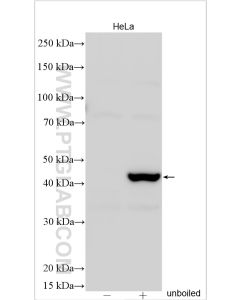 TMEM175 Polyclonal antibody proteintech 19925-1-AP