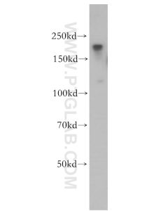 ZCCHC11 Polyclonal antibody proteintech 18980-1-AP