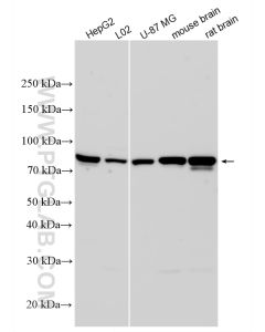 ACSS2 Polyclonal antibody proteintech 16087-1-AP