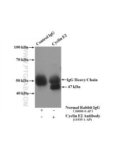 Cyclin E2 Polyclonal antibody proteintech 11935-1-AP