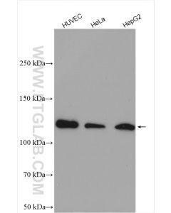 SREBF2 Polyclonal antibody proteintech 28212-1-AP