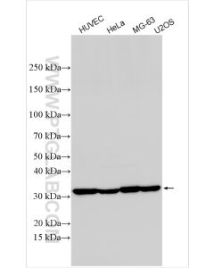 CTGF Polyclonal antibody proteintech 25474-1-AP