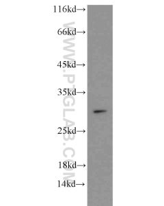 SNAI1 Polyclonal antibody proteintech 13099-1-AP