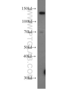USP28 Polyclonal antibody proteintech 17707-1-AP