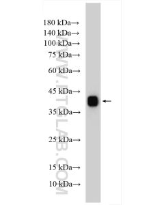 Clusterin Polyclonal antibody proteintech 12289-1-AP