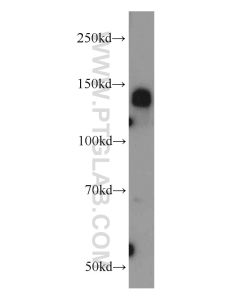 CEP97 Polyclonal antibody proteintech 22050-1-AP