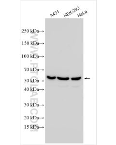 PEX14 Polyclonal antibody proteintech 10594-1-AP