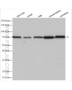 BNIP3L Polyclonal antibody proteintech 12986-1-AP