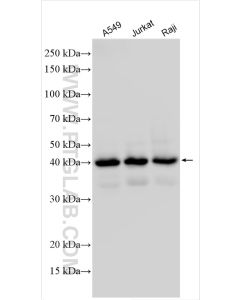 SHARPIN Polyclonal antibody proteintech 14626-1-AP