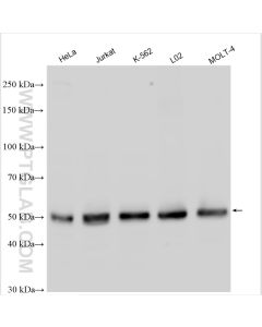 WTAP Polyclonal antibody proteintech 10200-1-AP