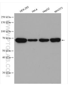 IGF2BP3 Polyclonal antibody proteintech 14642-1-AP