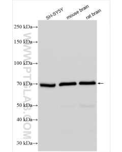 Cannabinoid receptor 1 Polyclonal antibody proteintech 17978-1-AP