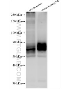 SGLT2 Polyclonal antibody proteintech 24654-1-AP