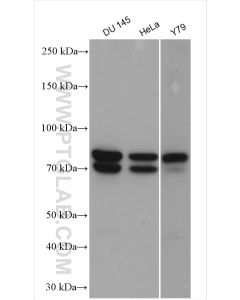 MPP5 Polyclonal antibody proteintech 17710-1-AP