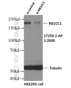RB1CC1 Polyclonal antibody proteintech 17250-1-AP