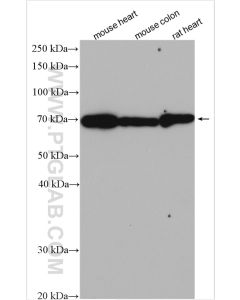 Decorin Polyclonal antibody proteintech 14667-1-AP