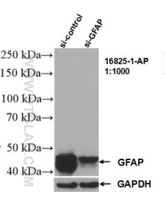 GFAP Polyclonal antibody proteintech 16825-1-AP