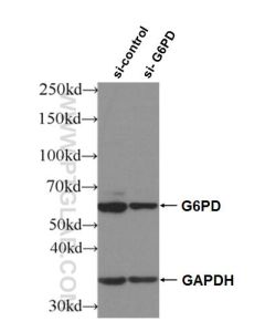 G6PD Polyclonal antibody proteintech 25413-1-AP