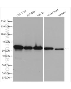 PDI Polyclonal antibody proteintech 11245-1-AP