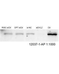 DVL2 Polyclonal antibody proteintech 12037-1-AP