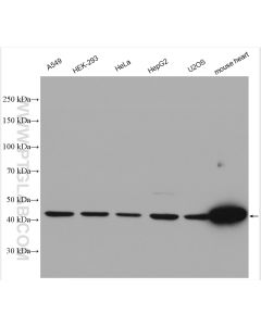 NDUFV1 Polyclonal antibody proteintech 11238-1-AP