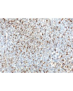 CD16 Polyclonal antibody proteintech 16559-1-AP