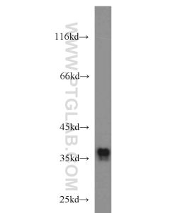 SIX1 Polyclonal antibody proteintech 10709-1-AP