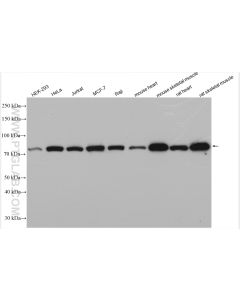 PFKP Polyclonal antibody proteintech 13389-1-AP