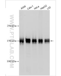 HDAC6 Polyclonal antibody proteintech 12834-1-AP
