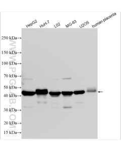 Serpin E1/PAI-1 Polyclonal antibody proteintech 13801-1-AP