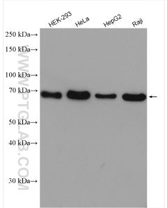 CTP synthase Polyclonal antibody proteintech 15914-1-AP