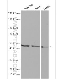 ATG4B Polyclonal antibody proteintech 15131-1-AP