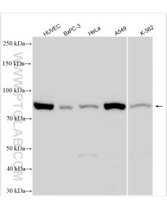 TGM2 Polyclonal antibody proteintech 15100-1-AP