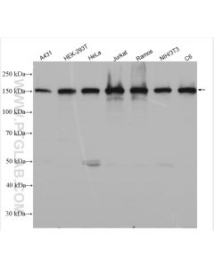 ROCK1 Polyclonal antibody proteintech 21850-1-AP