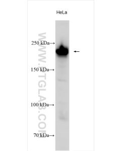 COL4A2 Polyclonal antibody proteintech 55131-1-AP