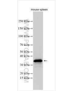 CD79b Polyclonal antibody proteintech 32152-1-AP