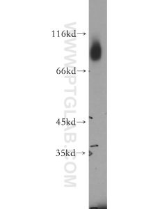 GFPT1 Polyclonal antibody proteintech 14132-1-AP