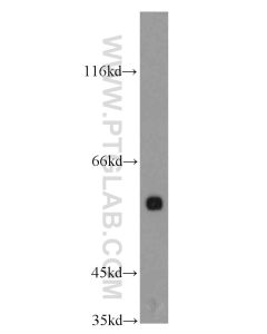 HNF1B Polyclonal antibody proteintech 12533-1-AP