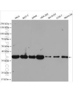 HTRA2 Polyclonal antibody proteintech 15775-1-AP