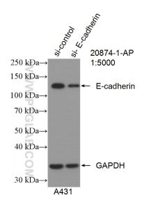 E-cadherin Polyclonal antibody proteintech 20874-1-AP
