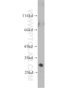 LOX Polyclonal antibody proteintech 17958-1-AP