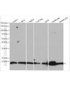 Cystatin C Polyclonal antibody proteintech 12245-1-AP