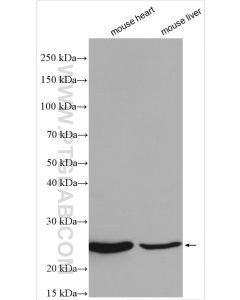 ATP5F1 Polyclonal antibody proteintech 15999-1-AP