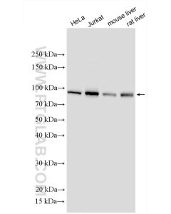 VPS16 Polyclonal antibody proteintech 17776-1-AP