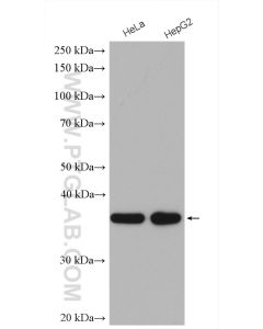 MRPS35 Polyclonal antibody proteintech 16457-1-AP