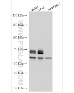 CAMKK2 Polyclonal antibody proteintech 11549-1-AP
