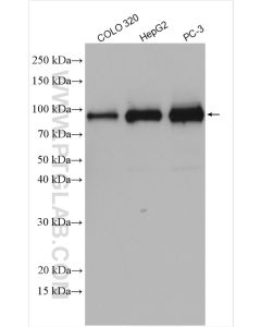 DDX21 Polyclonal antibody proteintech 10528-1-AP